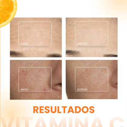 SUERO VITAMINA C - WONDER BEAUTY